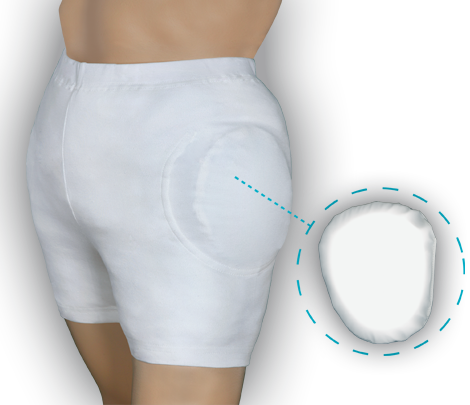 Hüftschutzhose zur Sturzprophylaxe ADL propant
